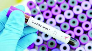 Эксперты: «Тесты на коронавирус могут дать отрицательный, а потом положительный результат»