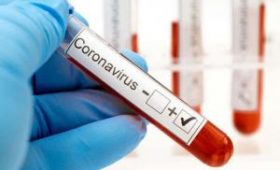 В США одобрили 1-й тест на коронавирус, который можно проводить самостоятельно в домашних условиях