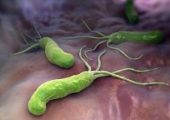 Комбинация трех препаратов эффективно уничтожает Helicobacter pylori, которая ответственна за гастрит и рак желудка