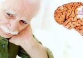 Назван предвестник болезни Альцгеймера, который можно обнаружить в молодости
