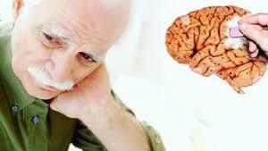 Назван предвестник болезни Альцгеймера, который можно обнаружить в молодости